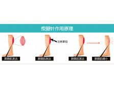 上海注射瘦腿针哪家医院好