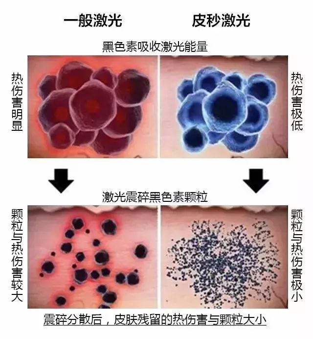 上海美莱艺术面雕节，6月整形钜优惠