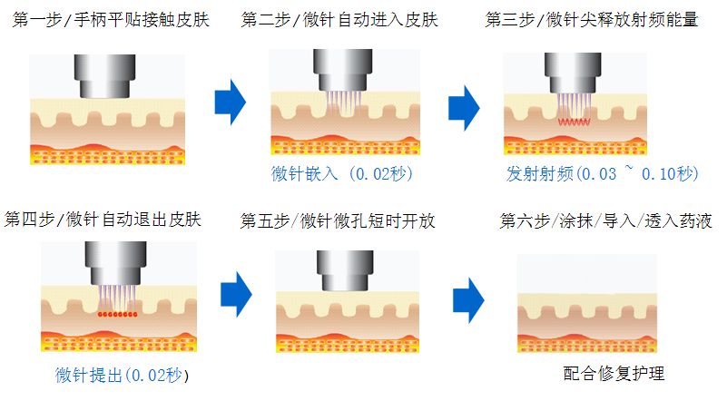 上海隆鼻注射医院哪家好，效果可以保持一年吗